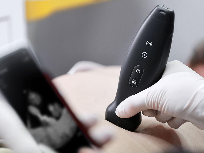 für Notfallmedizin TE Air kabelloses Ultraschallgerät