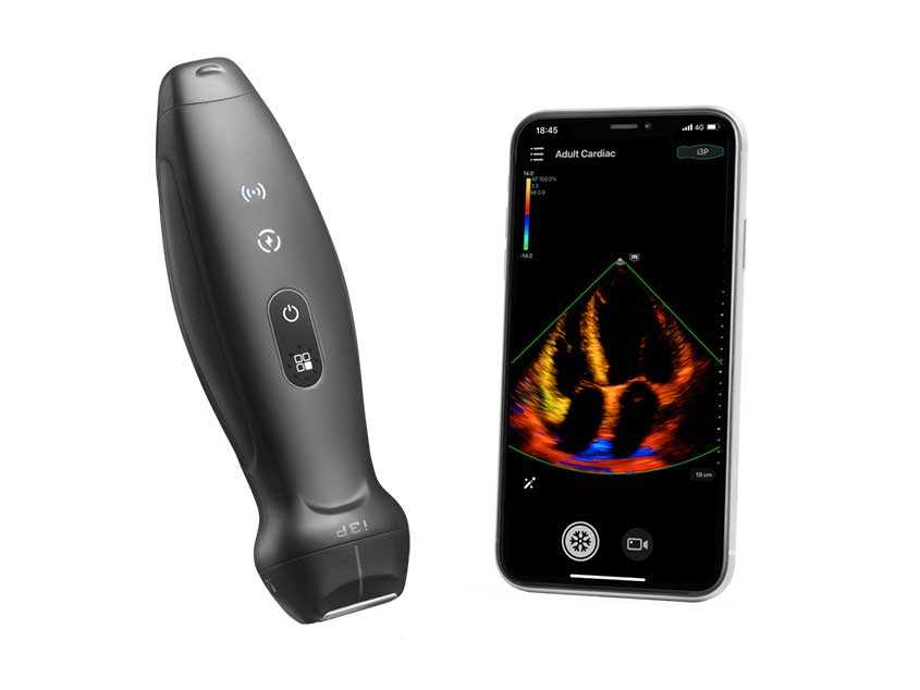 TE Air von Mindray Kabelloses Ultraschallgerät