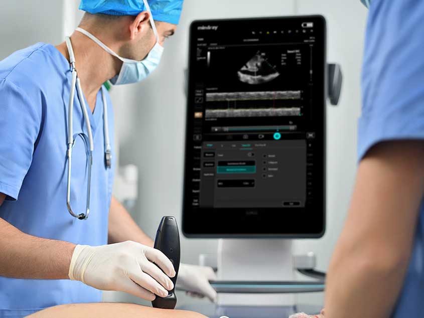 Ultraschallgerät TE Air